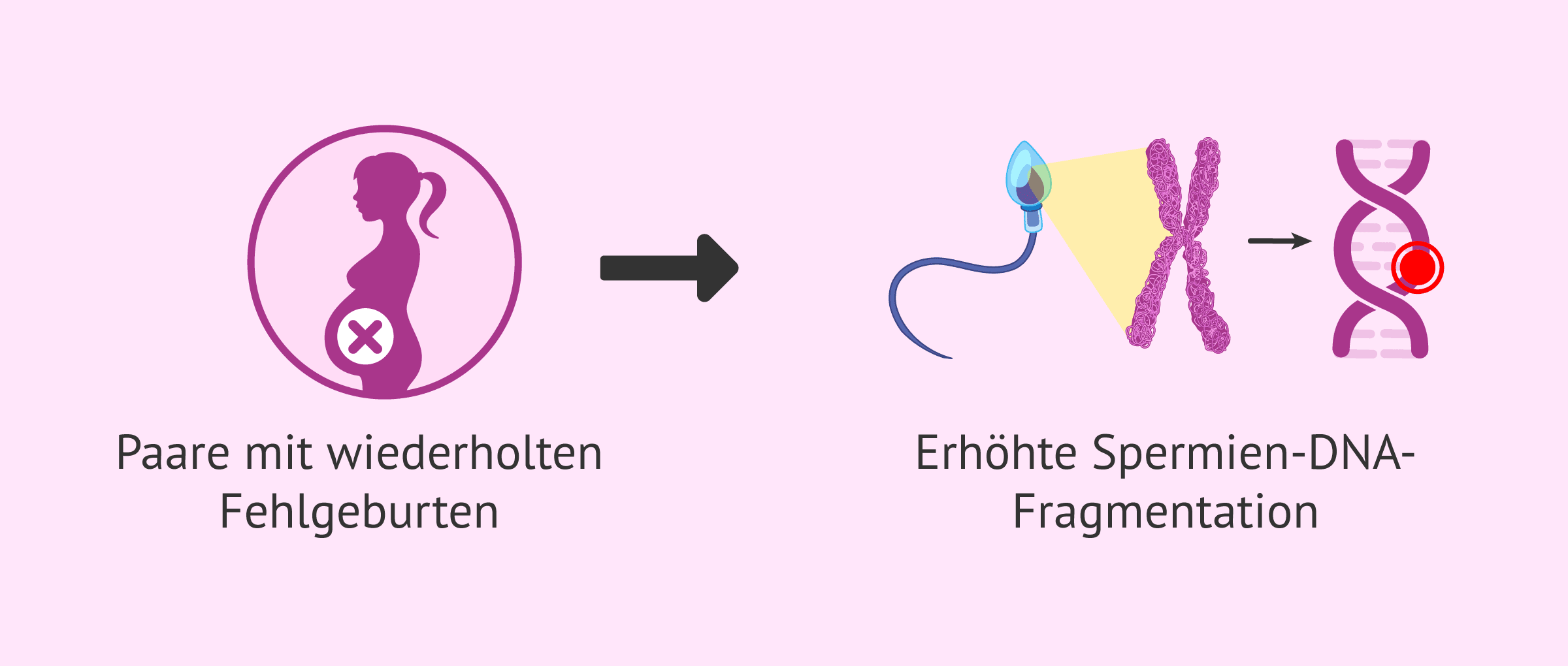 Imagen: Spermien-DNA-Fragmentation und wiederholte Fehlgeburten