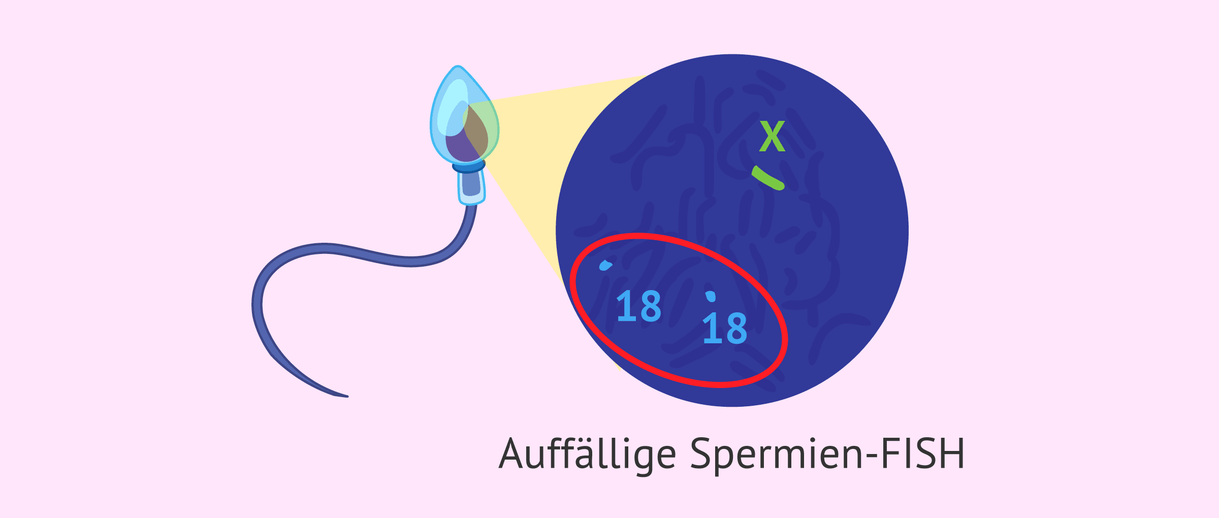 Imagen: Auffällige Spermien-FISH