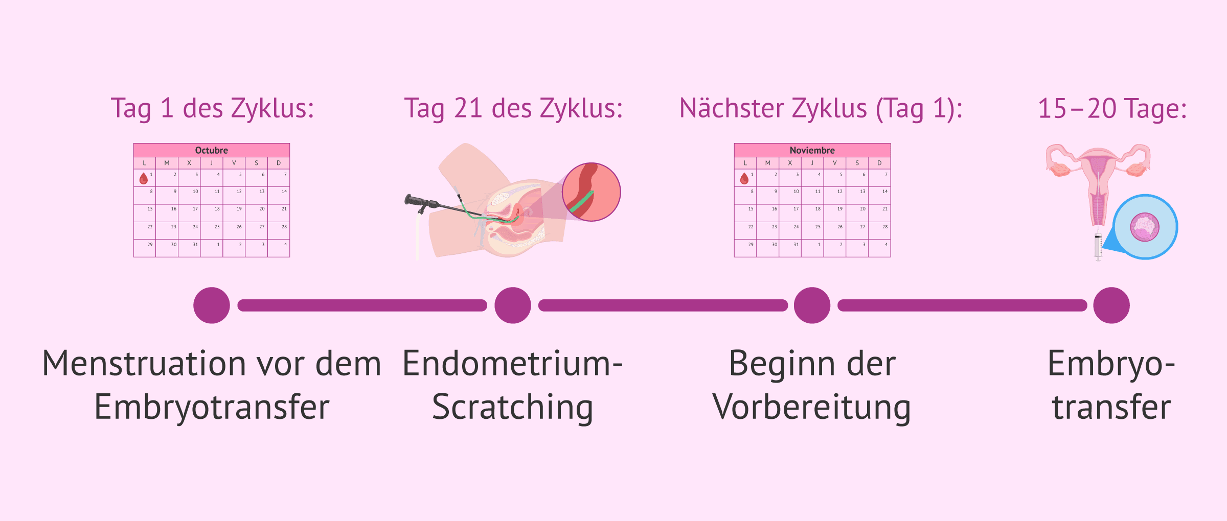 Imagen: Zeitpunkt für das endometriale Scratching