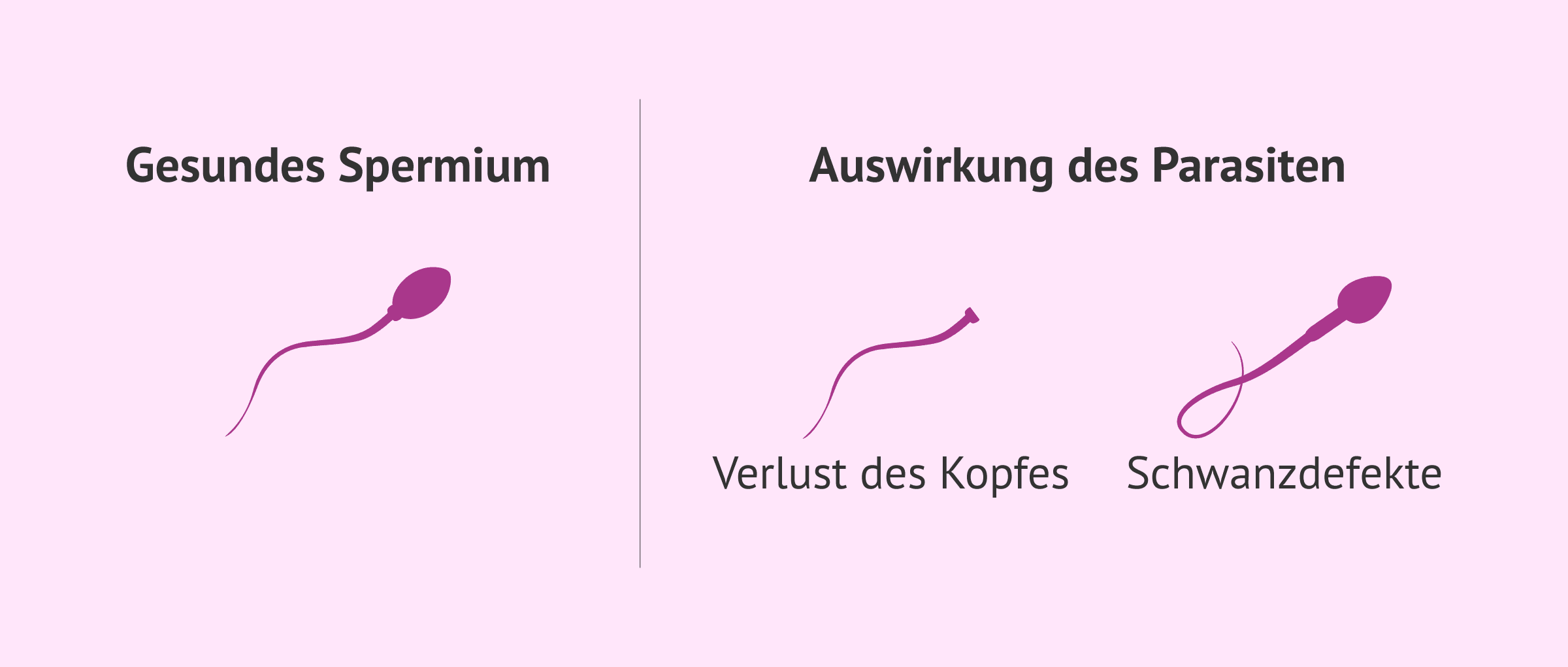 Imagen: Auswirkungen der Toxoplasmose auf die Spermien