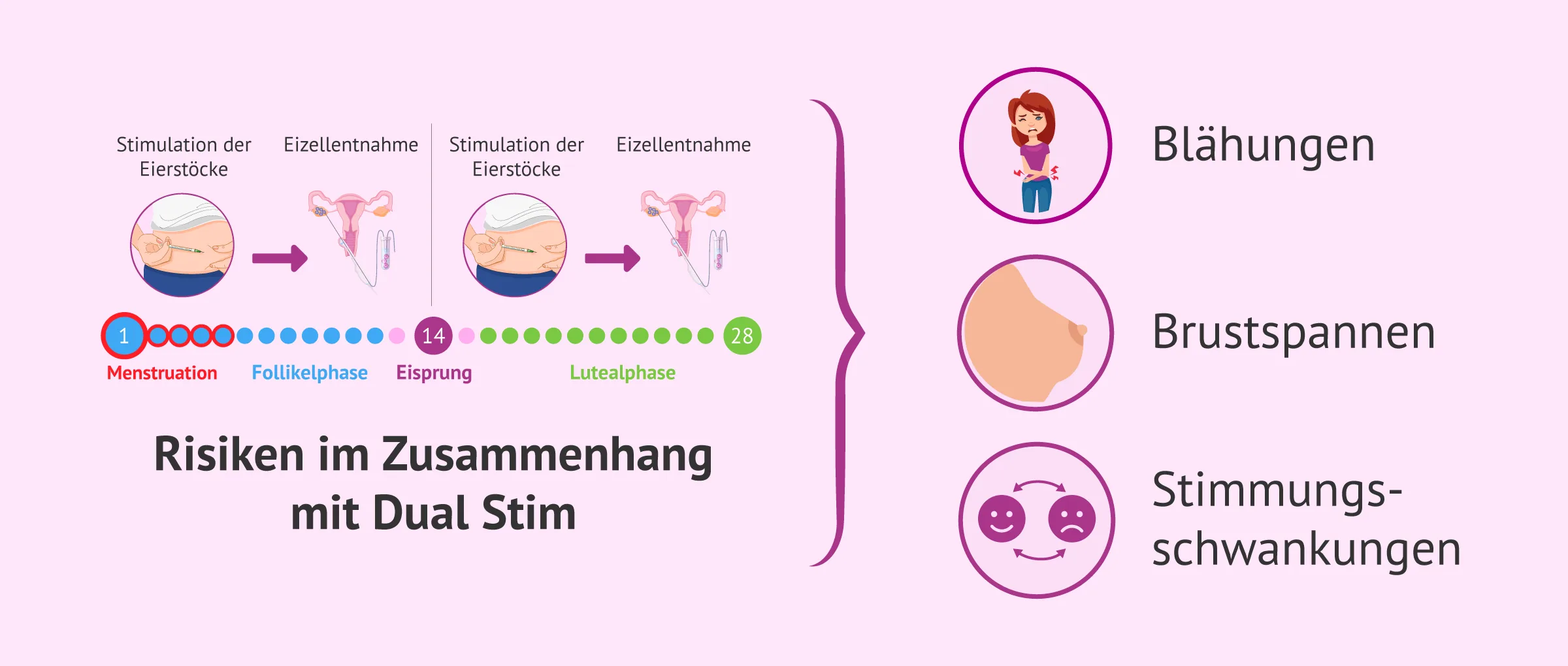 Risiken in der knstlichen Befruchtung (IVF) fr Mutter & Kind