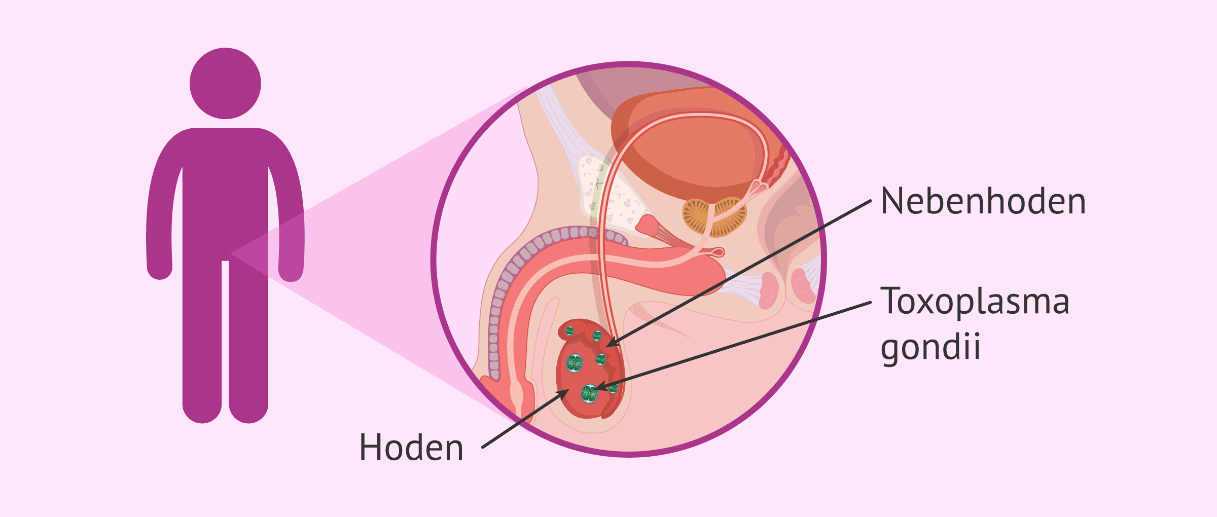 Toxoplasmose: Tatsächliche Auswirkungen auf menschliche Spermien