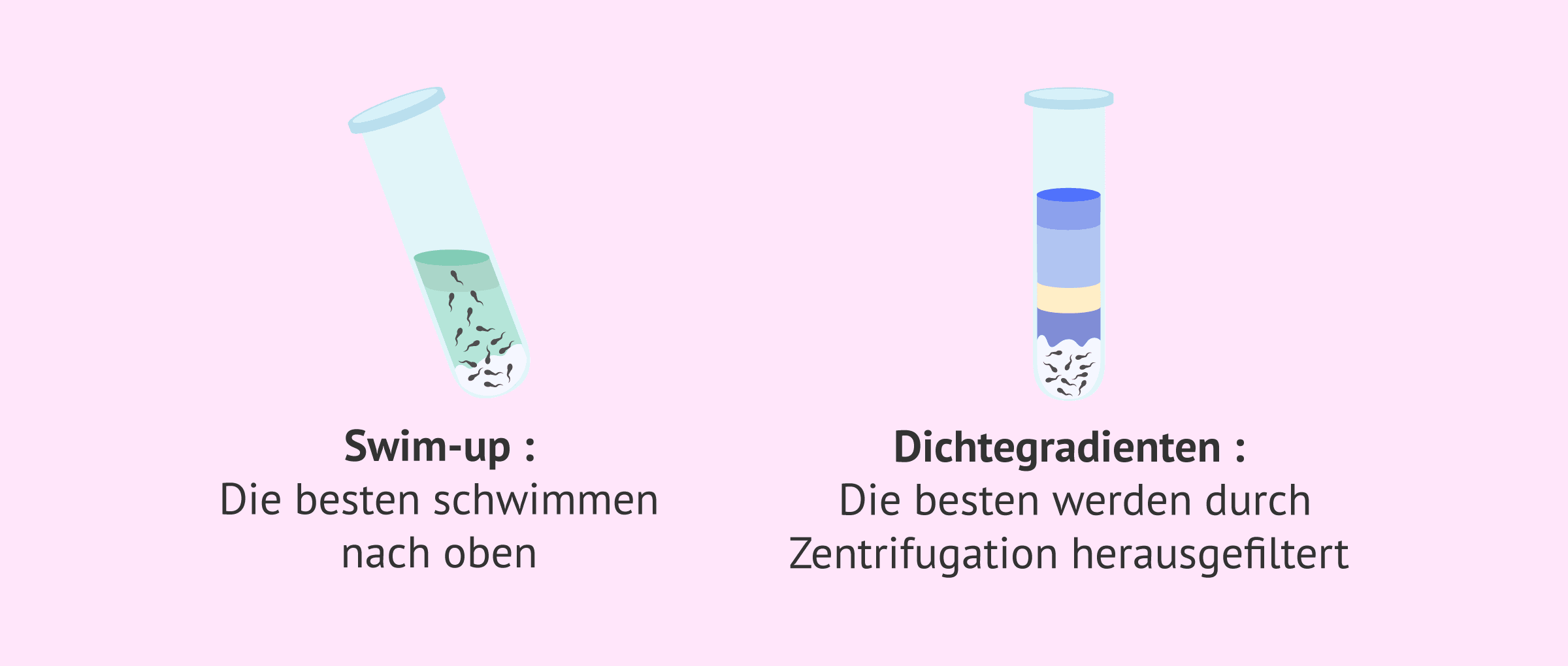 Imagen: Swim-up oder Gradienten? Was ist besser?