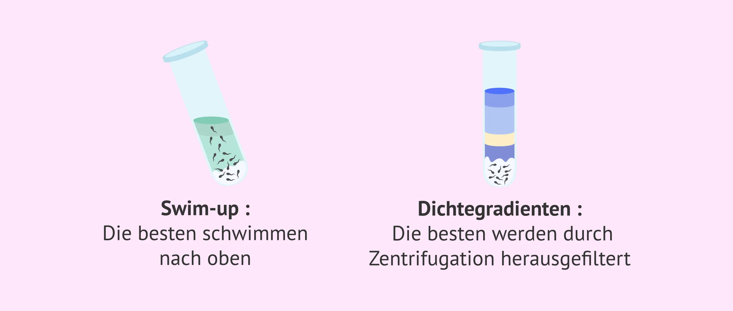 Spermienaufbereitung: Die Wissenschaft widerlegt einen Irrglauben über den Erfolg
