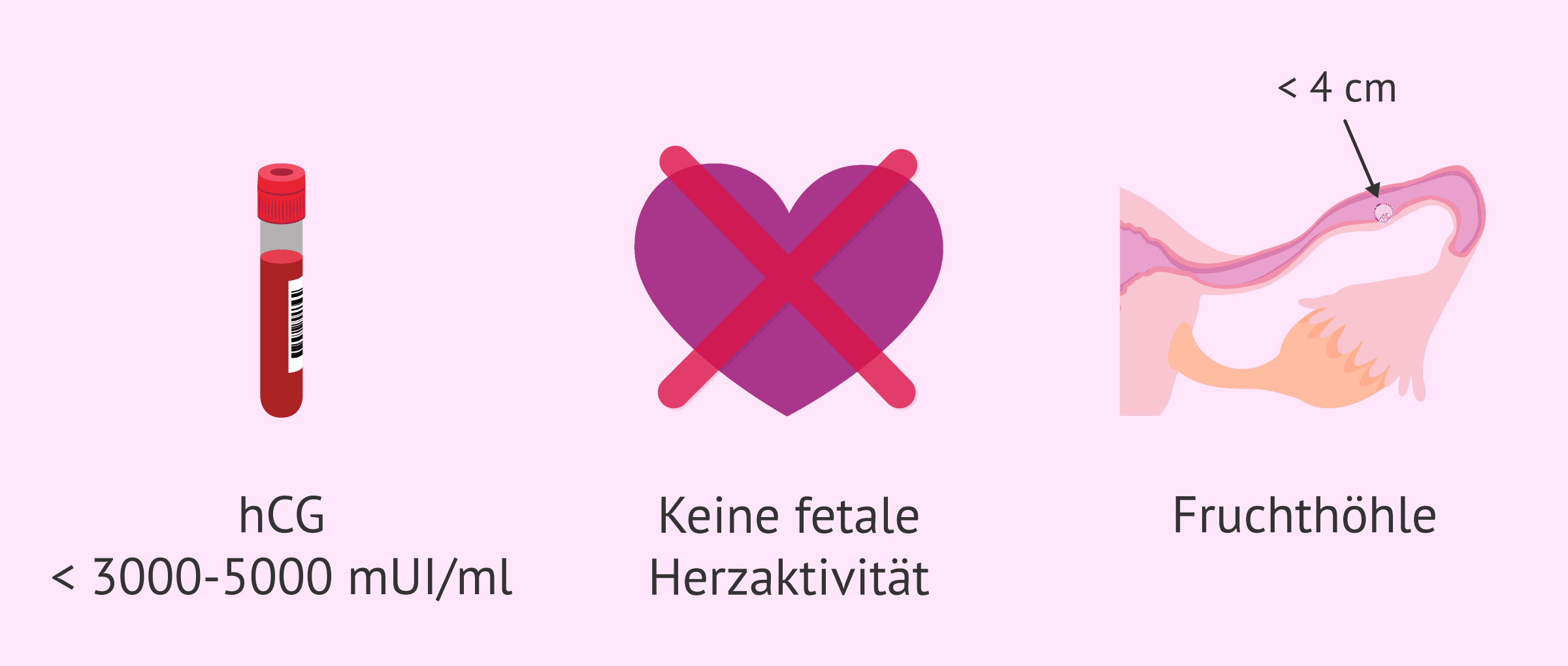 Imagen: Medikamentöse Behandlung einer ektopischen Schwangerschaft