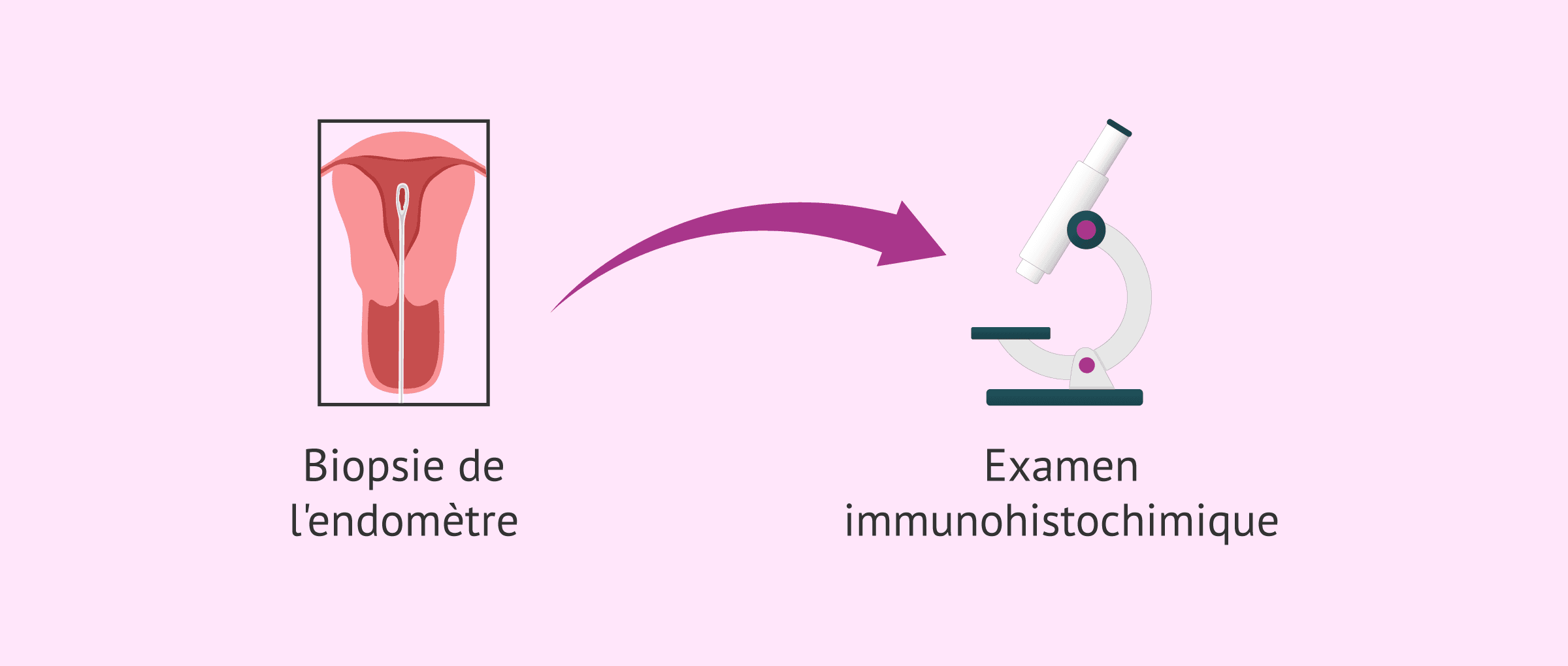 Imagen: Probleme bei der Diagnose der chronischen Endometritis