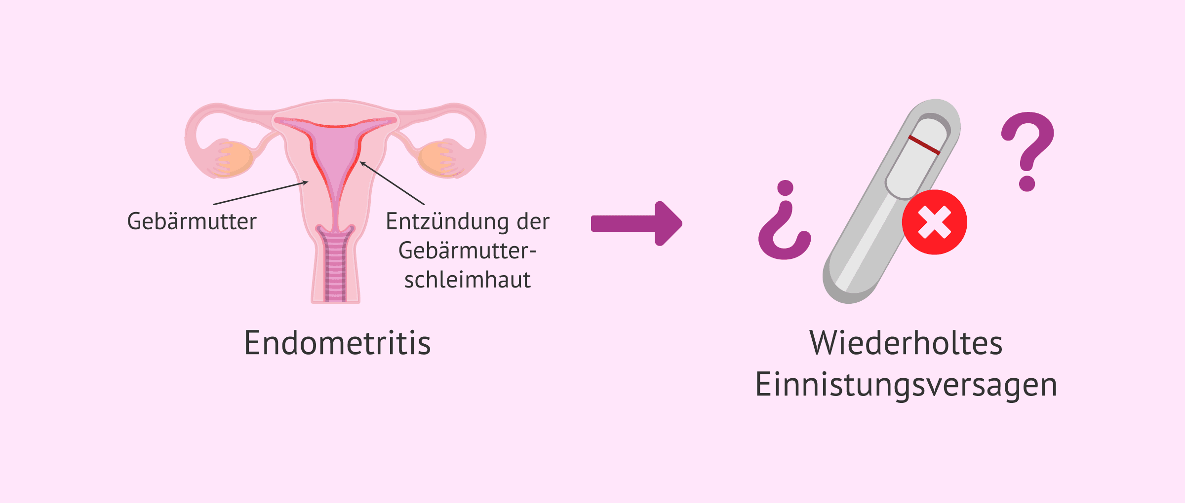 Chronische Endometritis: Die große Wahrheit beim Implantationsversagen