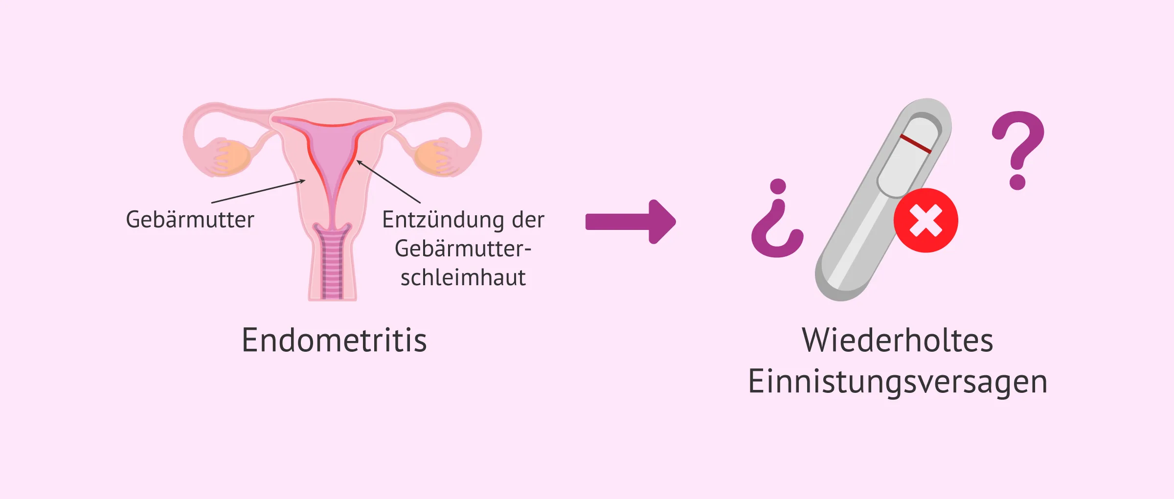 Chronische Endometritis: Die große Wahrheit beim Implantationsversagen