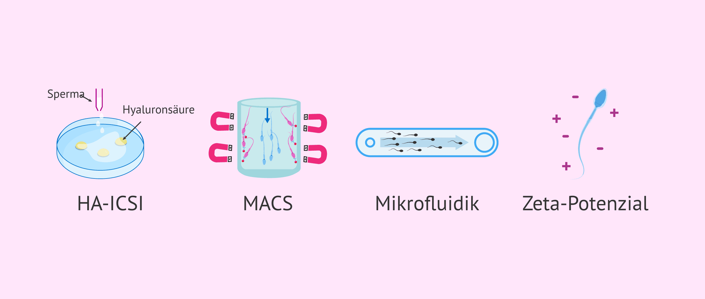 Imagen: Fortschrittliche Techniken der Spermienselektion
