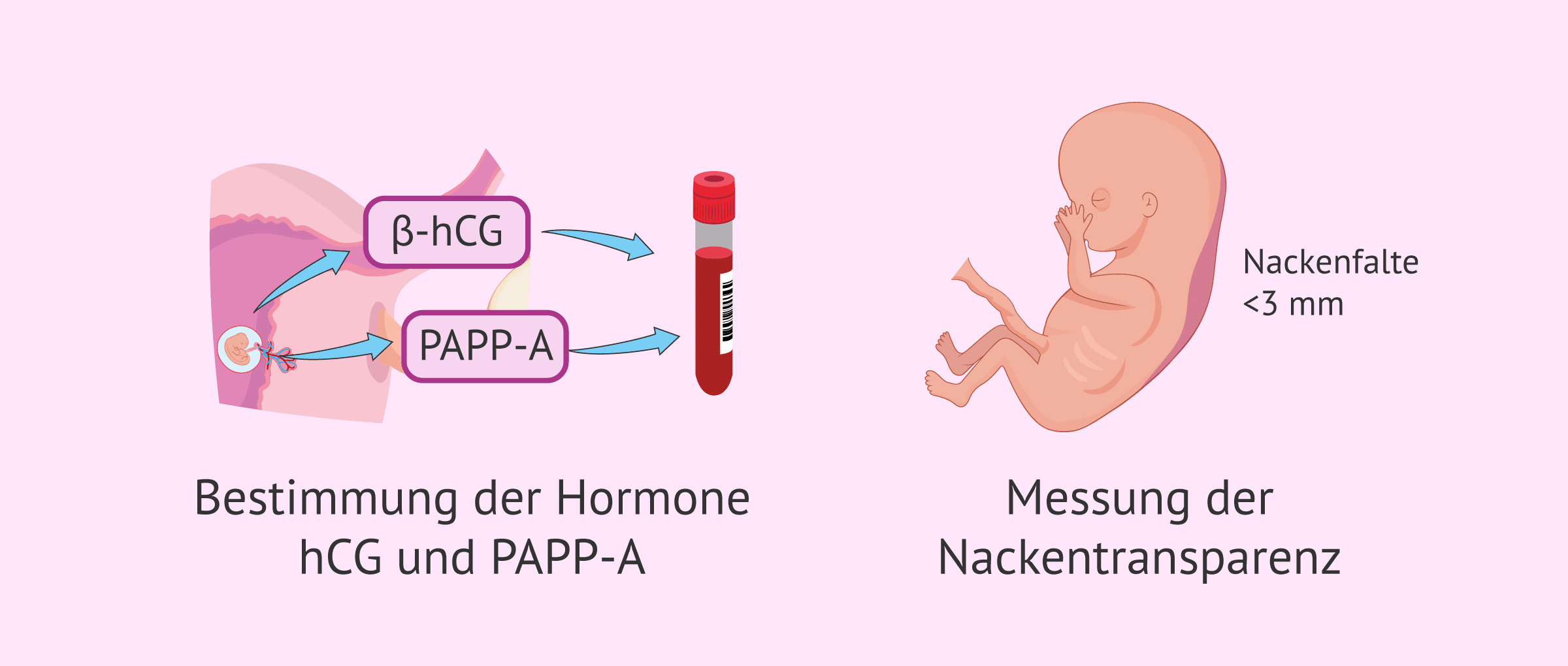 Imagen: Medizinische Untersuchungen in der 10. Schwangerschaftswoche