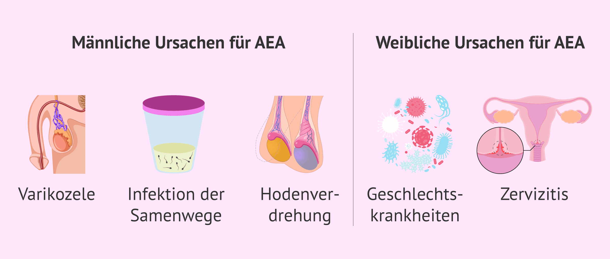 Imagen: Ursprung der Antispermien-Antikörper (ASA)