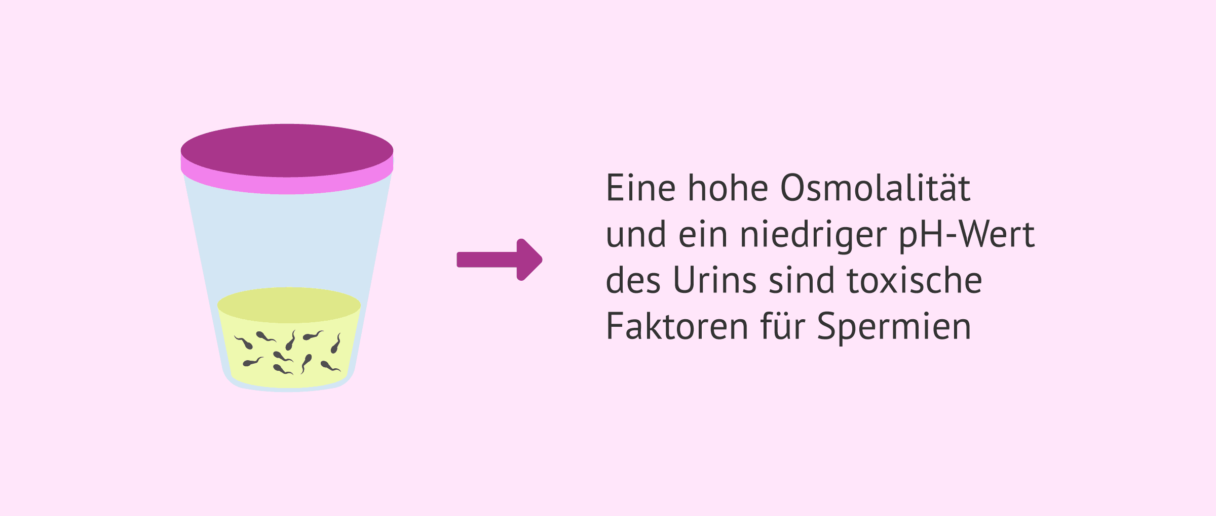 Imagen: Spermien im Urin nach retrograder Ejakulation