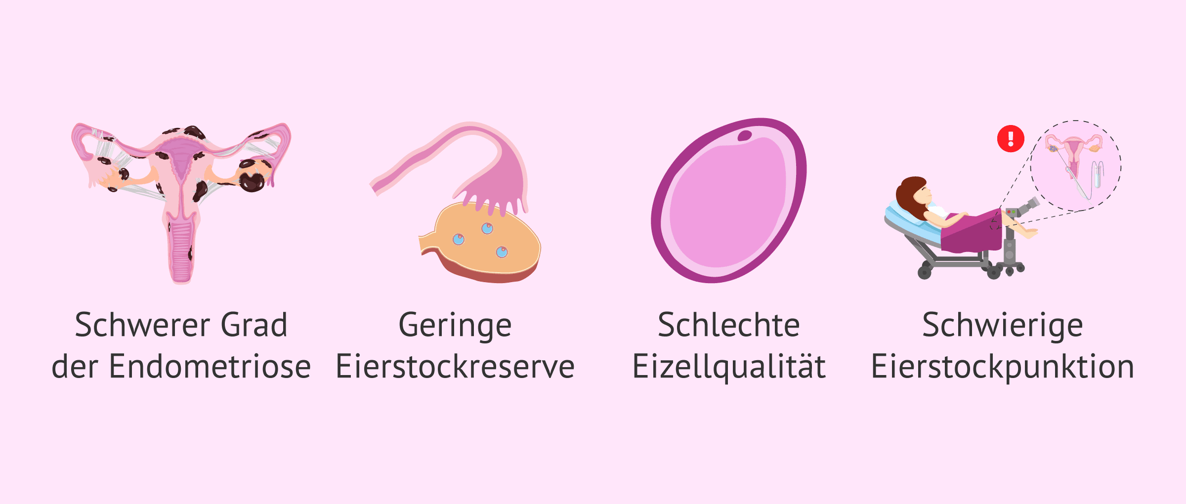 Imagen: Indikationen für eine Eizellspende bei Frauen mit Endometriose