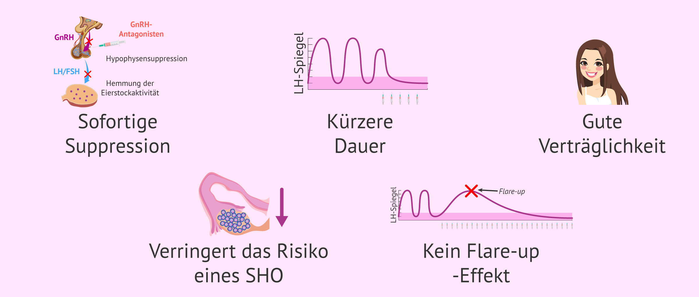Imagen: Vorteile von Protokollen mit GnRH-Antagonisten